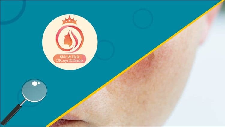 Mastering Sensitive and Damaged Skin: Science to Practice